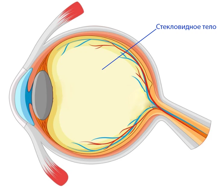 стекловидное тело глаза