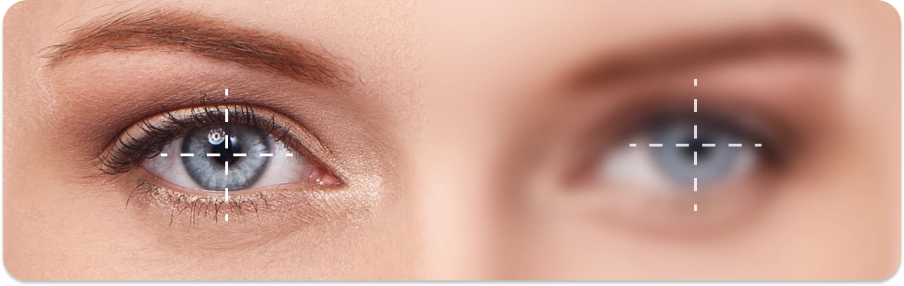 Резь в глазах: причины появления, симптомы, лечение