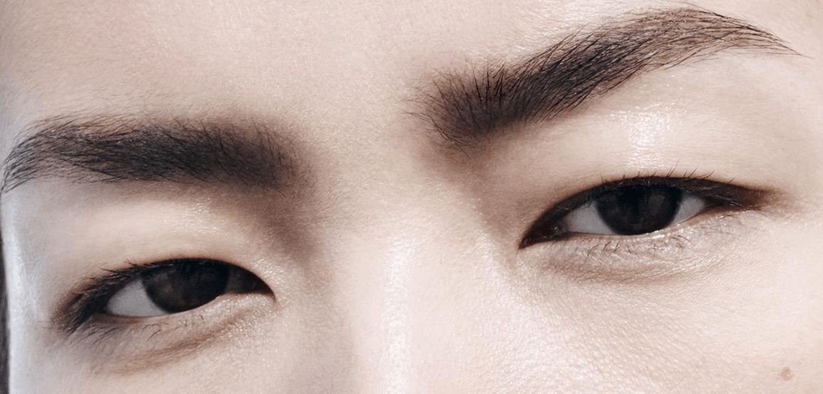 эпикантус у людей с узким разрезом глаз