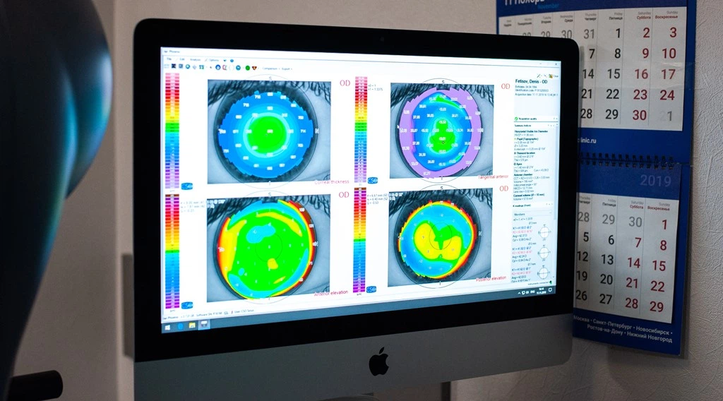 кератотопогрвфия