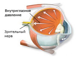Катаракта глаз лечение в москве thumbnail