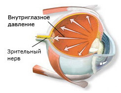 Лазерная коррекция глаукомы и катаракты thumbnail